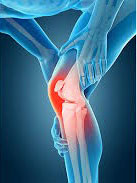 Knee on Trac For Knee Pain in Fort Worth TX